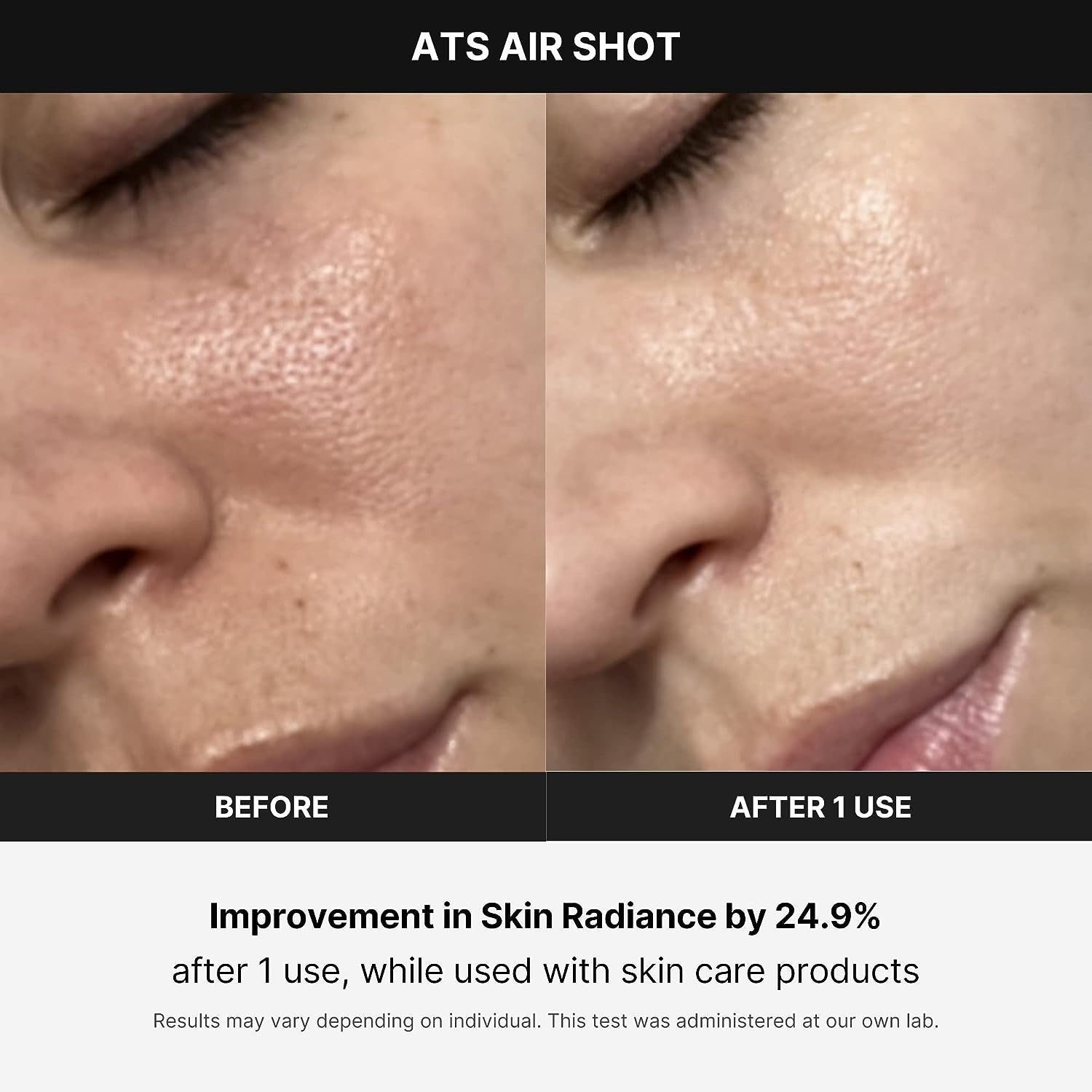 Age-R ATS Air Shot - Microneedling Skin Care Device for Pore Tightening, Enhanced Absorption, and Smoother Skin Texture - Exfoliation and Skin Rejuvenation - Korean Skincare